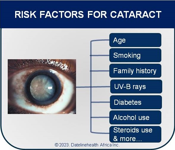 Risk factors for cataracts